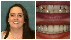 South Tampa Dentist | Dentist Near You | Dentist in South Tampa